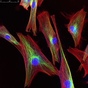 Trypsin EDTA and EDTA-Free