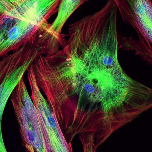 Cell Culture Media